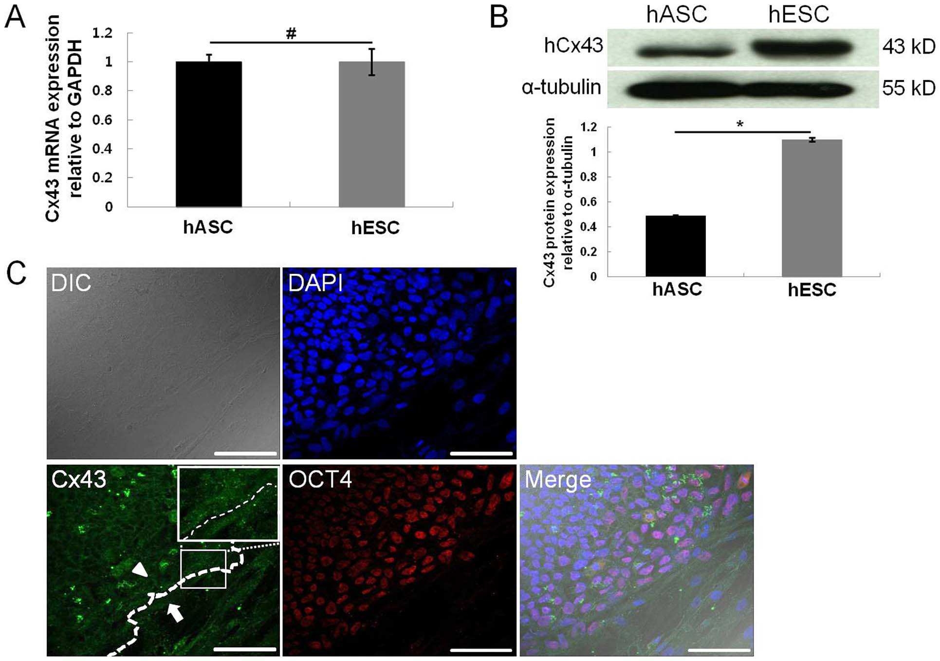 Expression of Cx43 in hESCs and hASCs. The expression of endogenous Cx43 in hESCs and hASCs was confirmed by qRT- PCR (A) and Western blot analysis (B). Expression of OCT4 (red) and Cx43 (green) in hESCs and hASCs was observed by immunocytochemistry (C). Nuclei were counterstained with DAPI (blue). The arrow head indicates the expression of endogenous Cx43 in hESCs adjacent to hASCs (arrow). The white box indicates the Cx43 expression at the border line. All data are shown as the mean 6 the standard deviation (SD) (n = 4; # , p.0.05; * , p,0.05). Scale bar, 100 mm.
