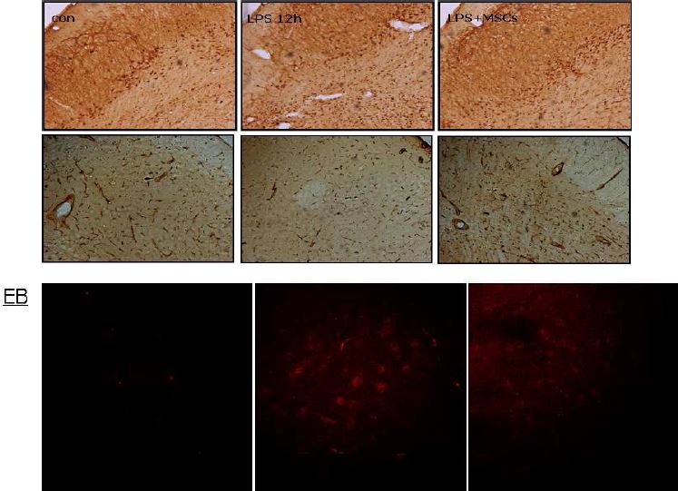 MSCs 투여 후의 BBB 안정화 효과 (상측: Evans blue, 하측; neutrophil 침투 정도)