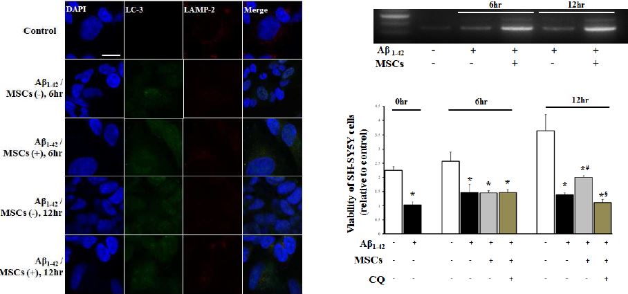 세포사가 유발되고 자가 소화 작용 표지 단백질의 Fig.15. 발현이 증가한 20uM Aβ1-42를 24시간 처리후 중간엽 줄기세포를 trans-well을 이용하여 동시 배양하였을 때, 중간엽 줄기 세포 동시 배양군에서 자가 소화 작용 표지단백의 발현이 증가한 6시간 12시간 동시 배양 실험군에서 자가 소화 작용 표지단백 (LC-3)와 라이소좀의 표지 단백질 (LAMP-2)의 형광 현미경을 통한 관찰 및 PCR을 이용한 라이소좀 활성도 (cathepsin-B) 증가 검증. 중간엽 줄기세포 6시간 12시간 동시 배양 실험군에 라이소좀 활성 억제제인 Chloroquine을 처리하여 중간엽 줄기세포 동시 배양에 의한 세포 생존율 증가가 라이소좀 활성 증가에 의한 것임을 확인.