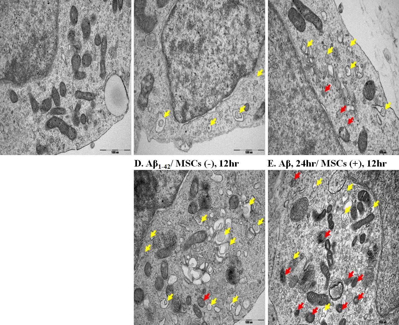 세포사가 유발되고 자가 소화 작용 표지 단백질의 발현이 증가한 20uM Aβ1-42를 24시간 처리후 중간엽 줄기세포를 trans-well을 이용하여 동시 배양하였을 때, 중간엽 줄기 세포 동시 배양군에서 자가 소화 작용 표지단백의 발현이 증가한 6시 간 12시간 동시 배양 실험군에서 세포내 이중막을 형성하고 있는 autophagosome (노란색 화살표)와 autophagosome과 라이소좀의 결합된 형태의 autolysosome (빨간색 화살표)의 형성을 전자 현미경을 이용하여 관찰.