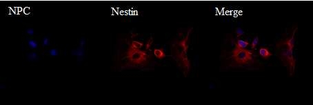 해마 부위에 신경 세포의 분리 후, 표지 단백질인 nestin (red) 발현을 확인