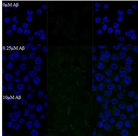신경 미세아교세포에 아밀로이드 베타 저농도 (0.25uM)와 고농도(10uM)를 24시간동안 처리한 후, 신경 미세아교세포에 발현되는 대식 작용을 나타내는 bead를 2시간 처리 후, 확인함. 처리된 신경 미세아교 세포에서 많은 형광의 bead가 관찰됨.