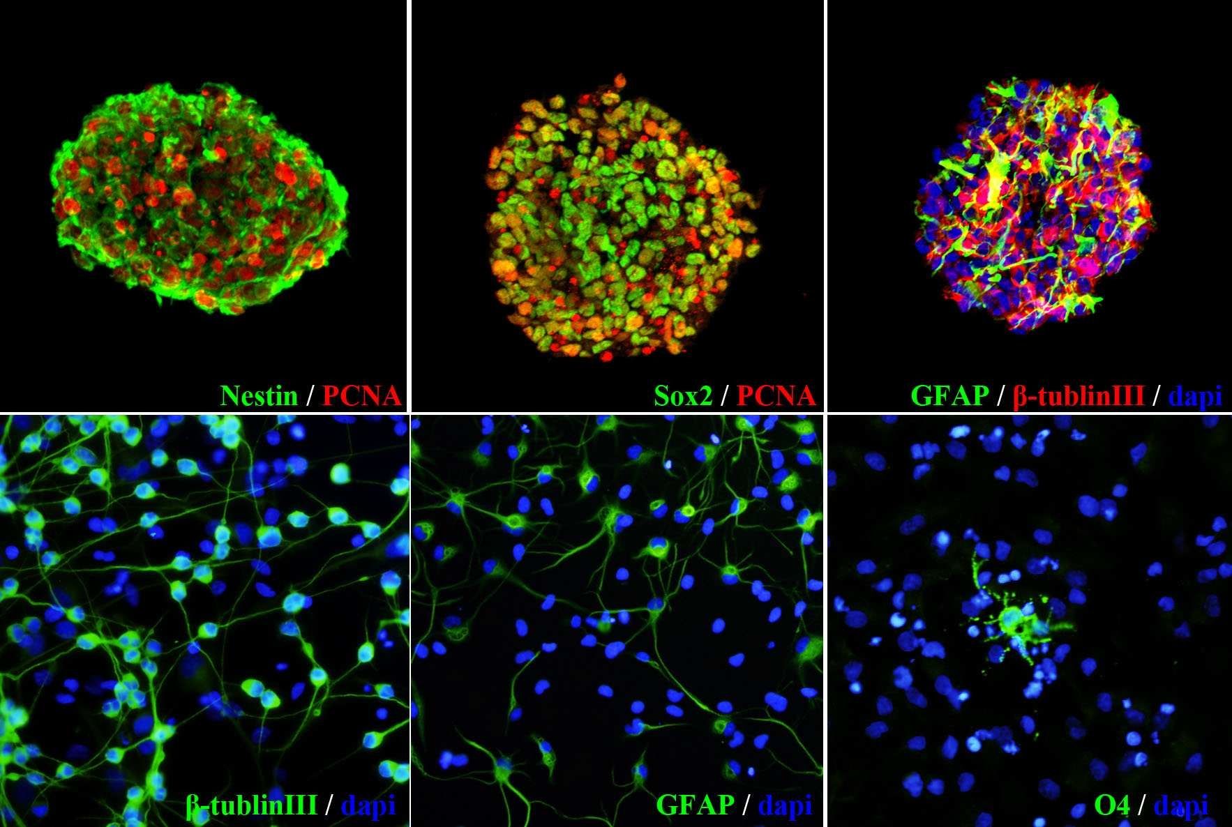 Neurosphere의 단면에서 면역조직화학 염색 결과 신경줄기세포 표지자인 nestin, Sox2가 증식세포 표지자인 PCNA와 동시 발현되고 있고, neuronal progenitor 표지자인 beta-tubulinIII와 astroglial progenitor 표지자인 GFAP를 발현하고 있어 신경줄기세포와 일부 신경전구세포의 특성을 동시에 갖고 있음을 확인함(upper panel). 분화능 시험에서는 early neuronal marker (beta-tubulinIII), astrocyte marker (GFAP), oligodendrocyte marker(O4)를 각각 발현하는 것을 관찰함으로써, 본 세포의 신경원세포 및 신경교세포로의 분화능을 확인하였음(lower panel).