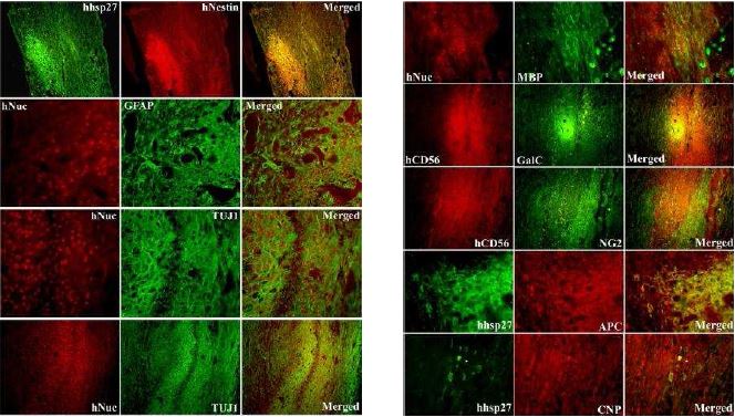 Differentiation patterns of donor-derived human neural progenitors-derived oligodendrocyte precursor cells in adult rats with traumatic spinal cord injury