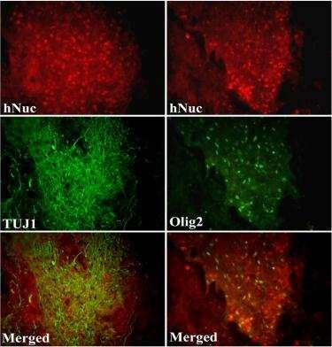 Robust engraftment & differentiation of transplanted human NSCs-derived neuronal precurosor cells (Ad-Ngn2 infected HFT13 cells)in adult rats with traumatic spinal cord injury