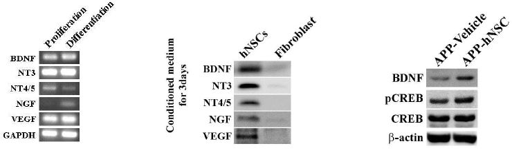 The expression of trophic factors in hNSCs and in brains of APPsw tgmice after hNSCs transplantation