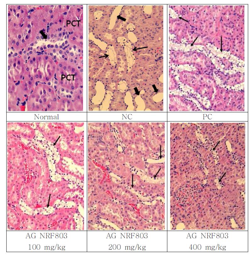 Structure of renal tubules. Tubular dilation as well as tubular degeneration and necrosis was a typical lesion in the streptozotocin-treated rat kidney.