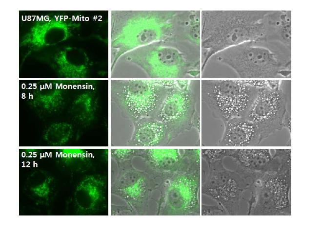 Monensin에 의한 mitochondria의 구조 변화