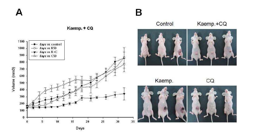 유방암 세포를 xenograft한 nude mice에서 kamepferol과 chloroquine의 단독 및병합 처리의 항암 효과 분석