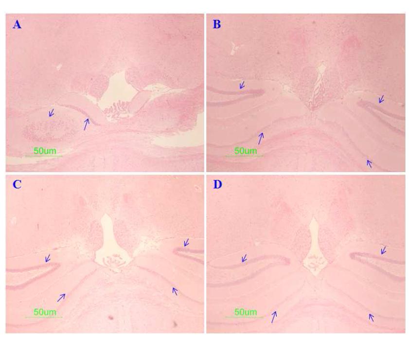 Histological analysis of hippocampal lesions and neural loss of APP-SWE Tg2576 Alzheimer's mice.