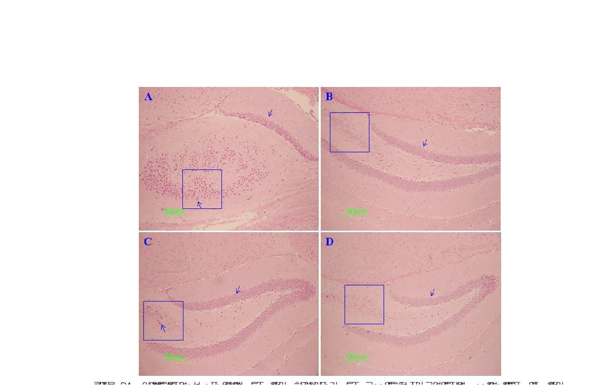 Histological analysis of the presence of macrophage/microglia activation in the hippocampus of APP-SWE Tg2576 Alzheimer's mice.