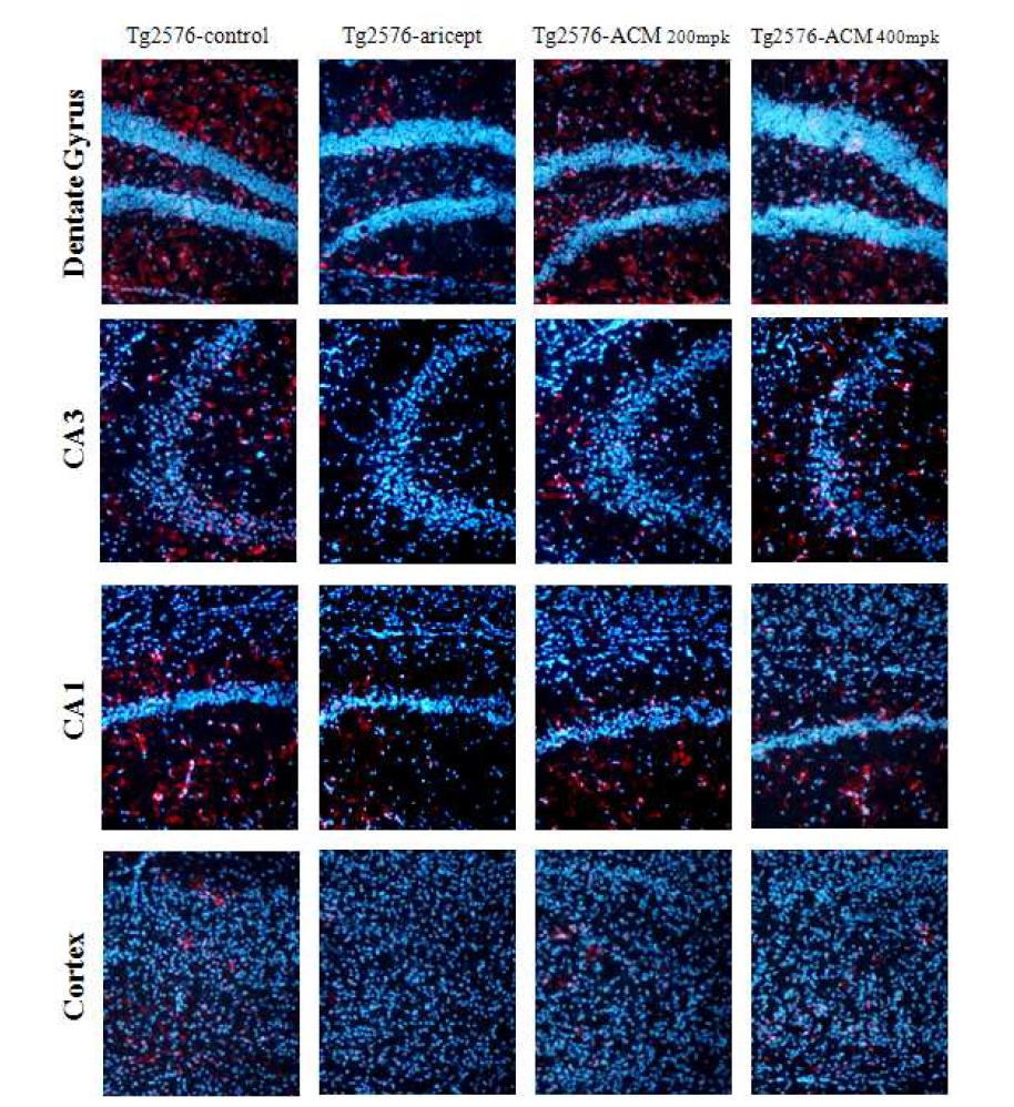 Immunohistochemistry analysis of GFAP protein tissue in the hippocampus of APP-SWE Tg2576 Alzheimer
