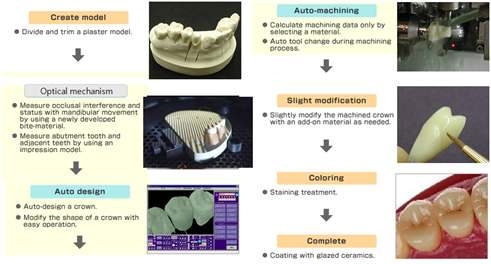 Dental CAD/CAM시스템을 이용한 보철물 제작 공정