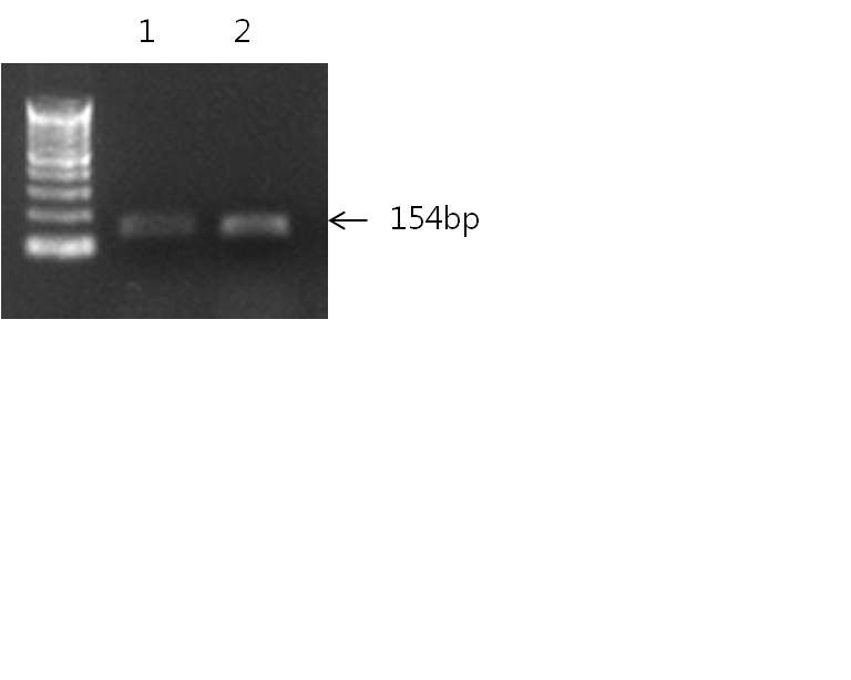 그림 3. 회전식 PCR 장치와 칩에서 증폭된 PCR 산물의 아가로스젤 전기영동