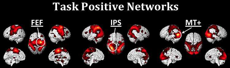 Task positive network으로 잘 알려진 3개의 영역(FEF: Frontal Eye Field, IPS: Inferior Parietal Sulcus, MT+: Middle Temporal)을 seed로 한 connectivity mapping 결과