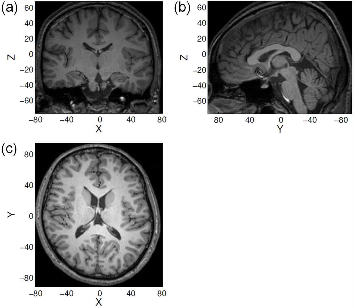 고해상도 뇌 구조영상 (T1 weighted image).