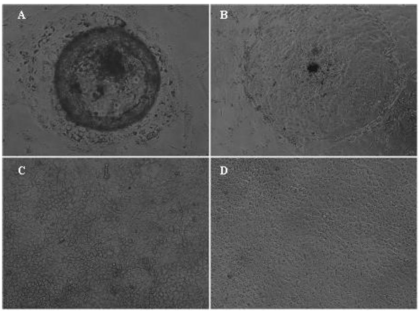 후기 배반포 배양 사진. A) 초기 배반포 부착, B) 초기 콜로니 사진, C) 계대후 콜로니 상세 사진, D) 콜로니 모습