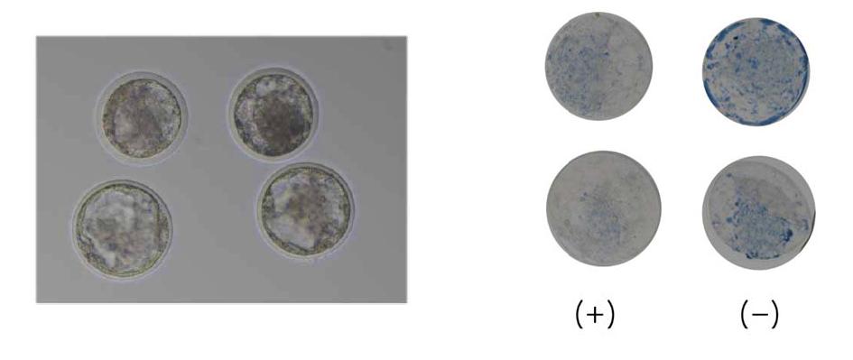 지방 대사 효율 증가 처리 배반포 사진과 염색 후 사진