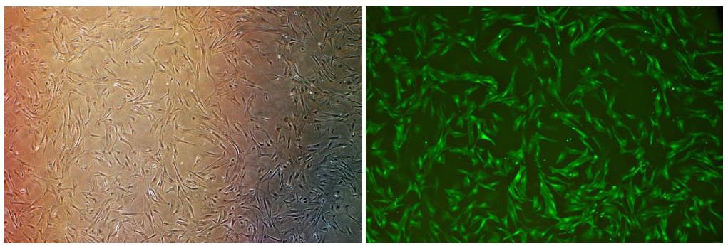 항생제와 GFP가 둘다 발현하는 유전자로 완성된 태아 섬유아세포