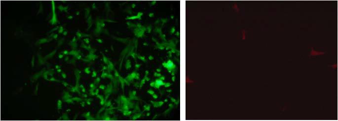 GFP (왼쪽)와 RFP (오른쪽)을 발현하는 태아 섬유아세포