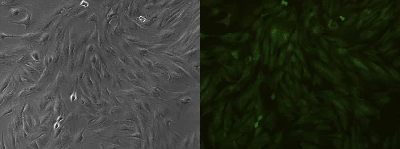소세포에 HR 벡터를 transfection을 한 후에 100%발현 세포 사진. Brightness (왼쪽), 형광사진 (오른쪽)