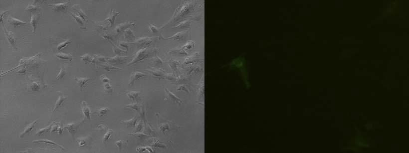 EF1-eGFP발현 세포가 Cre recombinase에 의해서 hIL2 유전자가 삽입되면서 GFP signal 이 사라지는 모습. Cre recombinase+hIL2 transfection을 실시 후 5일째 세포 사진 (Brightness-왼 쪽; Fluorescence-오른쪽)