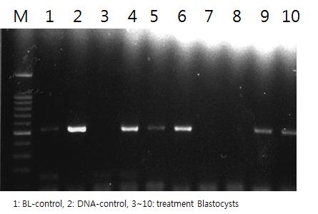 PCR을 이용한 배반포에서 인간 유전자 발현 검증