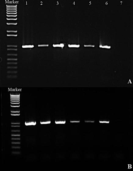 Figure 5. Detection of GFP gene with specific primer in cloned twin fetuses. Genomic DNA was extracted from several organs of twin (A, B) aborted cloned fetus. Marker: DNA size 1) Muscle, 2) Heart, 3) Lung, 4) Liver, 5) Spleen, 6) Kidney, 7) Negative