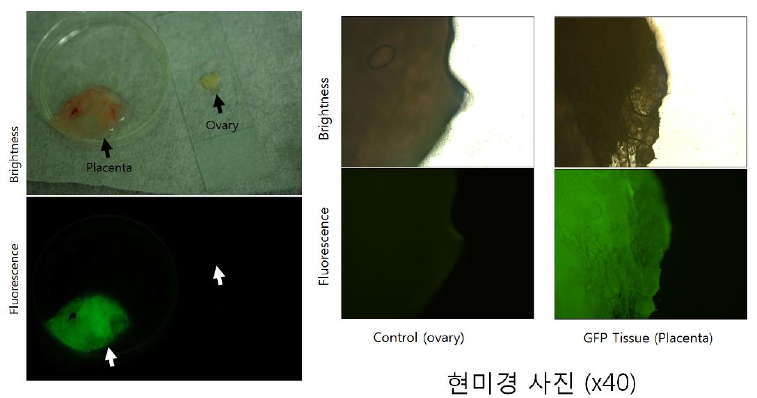 태반 조직에서 현미경과 형광 고글을 이용한 GFP 발현 사진