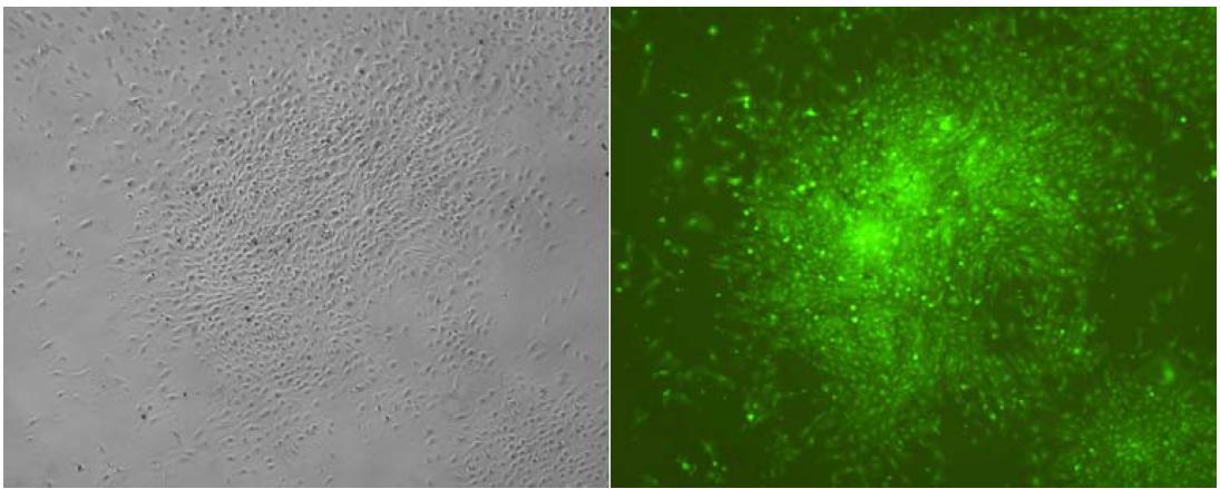 태반으로 분리된 세포의 bright 사진 (왼쪽)과 형광사진 (오른쪽)