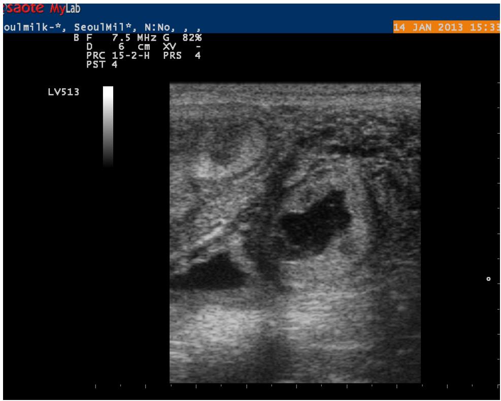 복제 수정란 임신 사진. 형질 전환 복제 수정란 이식 후 50일령에 초음파 진단을 하여 임신 여부를 관찰하였다.