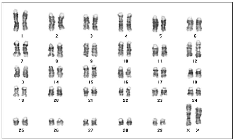 형질 전환 태아 유래의 세포 염색체 검사. 2n=60 (XX)