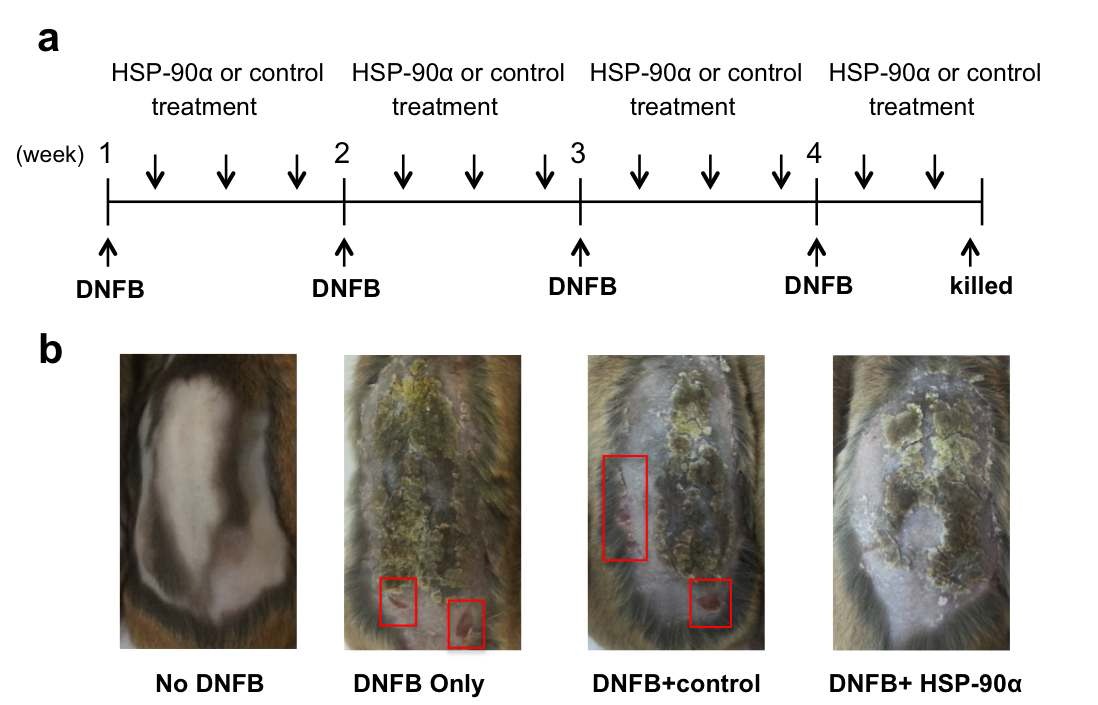 DNFB 도포에 의해 유발된 NC/Nga 마우스의 피부 손상 정도와 인간 열활성화 단백질 90a의 효과