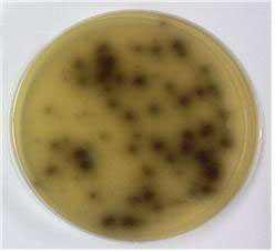 Escullin agar를 이용한 균주 분리 (β-Glucosidase 활성 균주)
