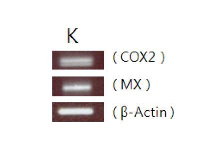 1st RT-PCR 결과 나타난 신장 조직에서의 COX2