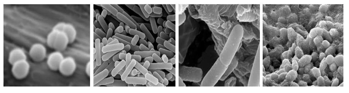 SEM (x20,000) of patented strains Pediococcus, Lactobacillus, Bacillus licheniformis DK42 and Saccharomyces ssp.