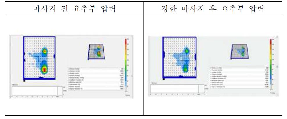 요추부 압통 압력 비교