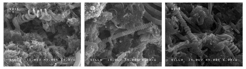 고분자와 카본코일을 복합시킨 전자현미경 표면 사진