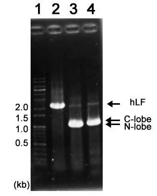 사람 락토페린 full length, 락토페린 N-lobe 그리고 락토페린 C-lobe의 PCR