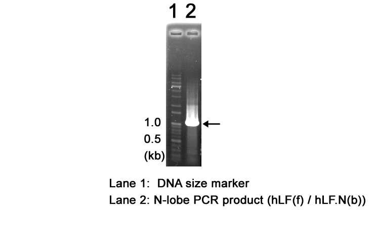 Tagging이 존재하지 않는 N-lobe 부분의 PCR product