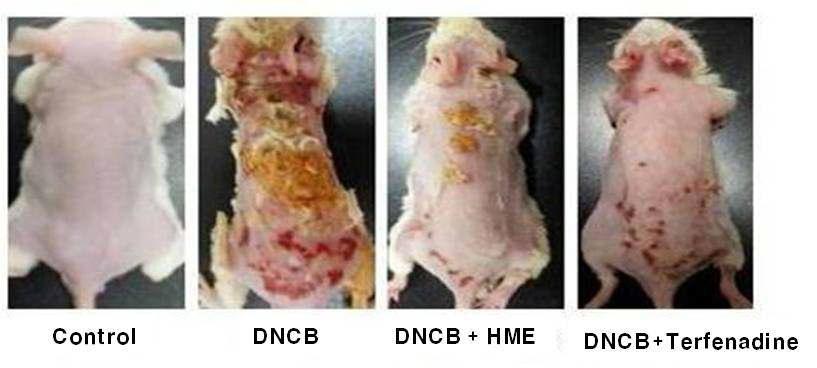 The effect of HME on the DNCB-induced dermatitis and IgE level serum