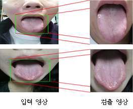 혀 관심영역 검출 결과