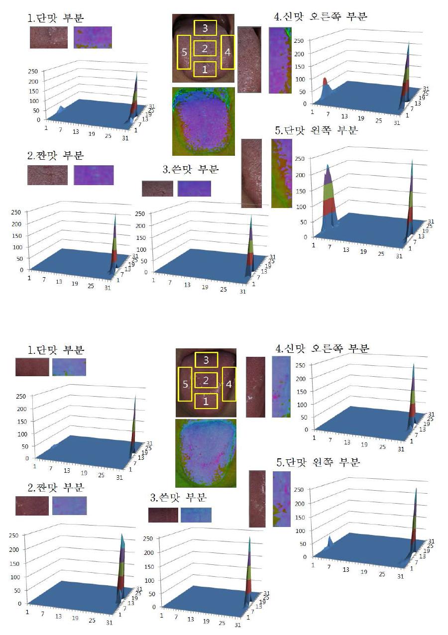 분할된 혀의 영역을 각각 히스토그램 통한 진단하는 과정