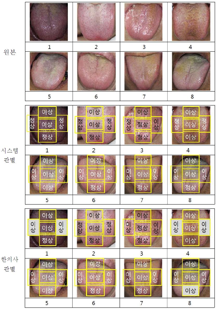 미각 영역별 진단