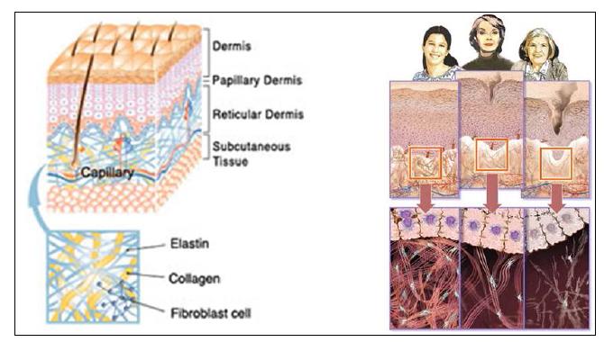 피부 조직 모식도와 노화에 따른 조직의 변화.