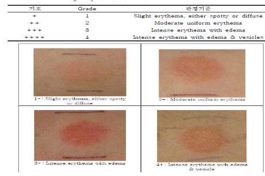 피부자극정도 평가 방법.