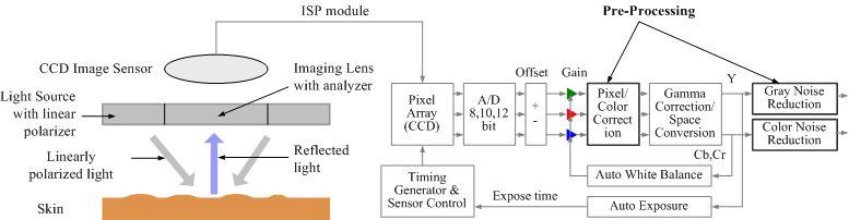 Dermoscopy CCD 이미지센서 ISP 모듈 내에 전처리 과정 포함