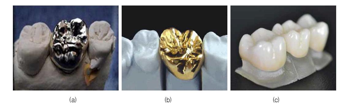 다양한 종류의 치아용 보철물 (a) 금속 크라운 (b) 골드 크라운 (c) 지르코니아