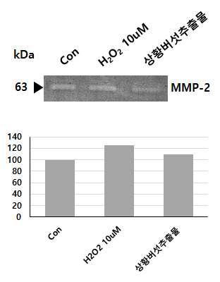 Zymography를 통한 상황버섯추출물의 HDF 세포의 MMP-2 활성 저해능.