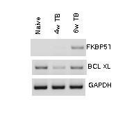 암의 경과에 따른 미분화 골수성 세포 내에서의 FKBP51 발현 확인 BALB/c 마우스에서 CT26 암세포 투여 후 4주, 6주 뒤 비장세포에서 분리한 미분화 골수성 세포에서의 FKBP51의 발현을 RT-PCR로 확인.